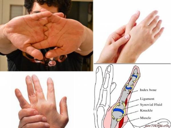 Những tác hại của việc thường xuyên bẻ khớp ngón tay